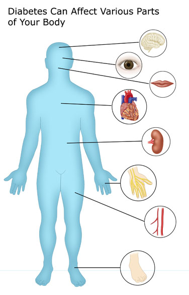 Diabetes information